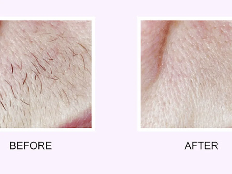 Abington Aesthetic & Laser Medical Center: Dr. Evan Zelinger D.O.